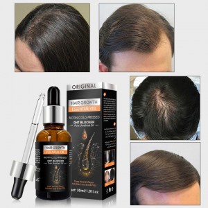 Pangangalaga sa buhok Growth Oil Serum repairing anti Loss